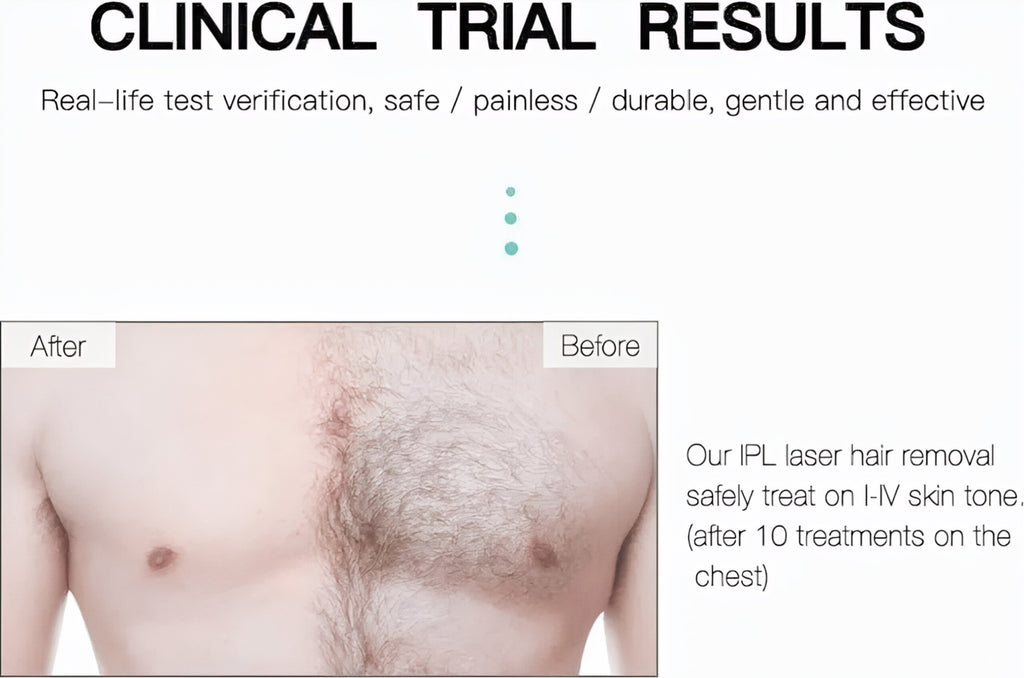 IPL Laser Hair Removal
Permanent Painless Laser Hair Removal Device